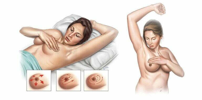 Kendi Kendine Meme Muayenesi Nedir?